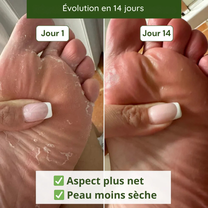 Savon Anti-Mycoses Botanikéo